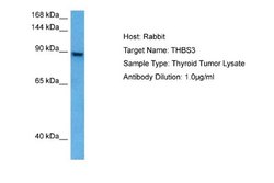 Thrombospondin-3 Rabbit anti-Human, Polyclonal, Novus Biologicals 0.1 mL | Buy Online | Novus Biologicals | Fisher Scientific